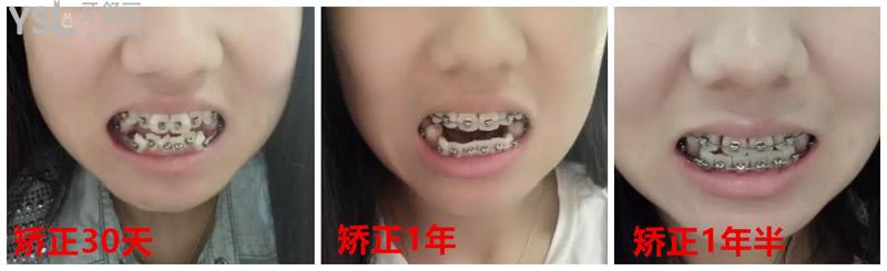 {49AD5222-2876-4363-A8B0-B0EBA7226AFE}_20200319142655_副本.jpg