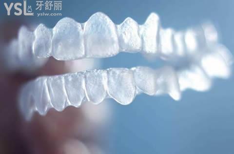 隱適美隱形矯正有年齡限制嗎？