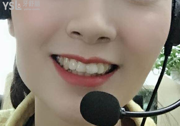 帶牙套后悔一輩子，我覺(jué)得不帶牙套才會(huì)后悔