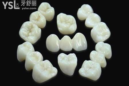 全瓷牙和烤瓷牙的區(qū)別有哪些？