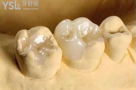 樹脂補牙后需要注意什么？