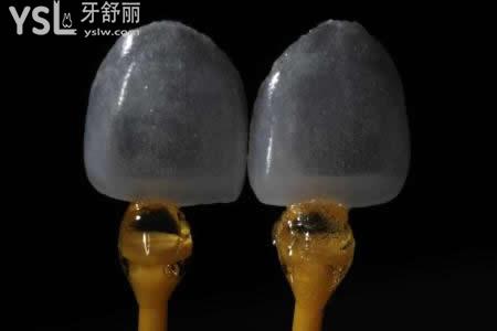 做3D超薄瓷貼面有什么禁忌癥？