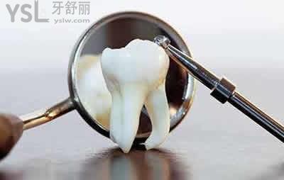 樹脂補(bǔ)牙出現(xiàn)白線的原因：