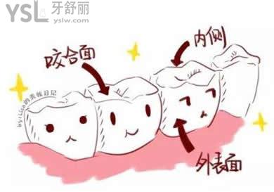 牙齒美白的方式有哪些？