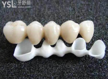 二氧化鋯全瓷冠特點： 