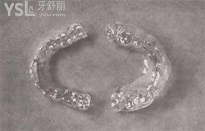時(shí)代天使隱形矯正適應(yīng)人群和優(yōu)點(diǎn)：