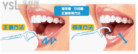 牙線棒.png