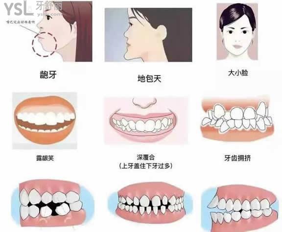 矯正 (10).jpg