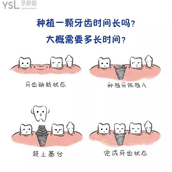 做了種植牙我不想活了？ (2).jpg