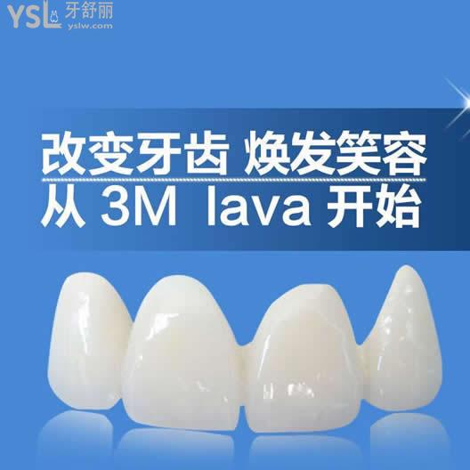 美國(guó)3m拉瓦全瓷牙