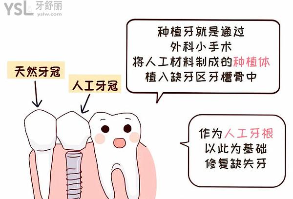 種植牙既然這么火，那種植牙人老了有沒有弊端？