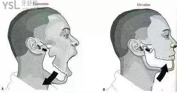 嘴突然張不開了怎么回事3