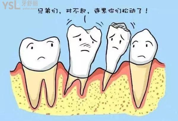 牙槽骨卡通配圖