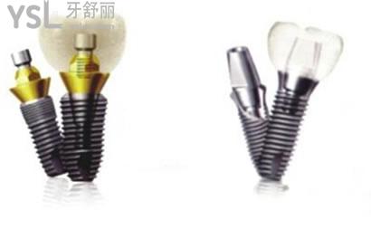 韓國(guó)登騰種植牙多少錢(qián)一顆，3900元一顆靠譜嗎？