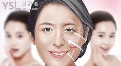 廣州聶云飛醫(yī)生做拉皮手術(shù)怎么樣？網(wǎng)友口碑實(shí)測(cè)！