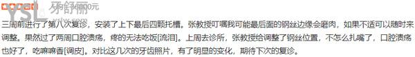 北京禾禾齒科口腔門診部正規(guī)靠譜嗎_地址_視頻_口碑好不好_收費標(biāo)準(zhǔn)_能用社保嗎?(正規(guī)靠譜/北京市朝陽區(qū)/口碑非常好/收費中等/暫不能用社保/教員醫(yī)生領(lǐng)銜/疑難牙齒矯正正畸/一城兩院)