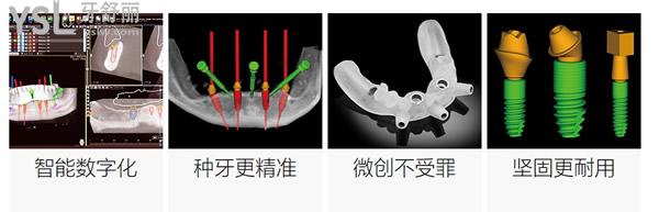中諾口腔e+立得用種植技術(shù)優(yōu)勢