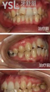 寧波尚善口腔門診部怎么樣