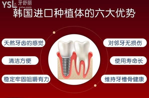 襄陽(yáng)時(shí)代口腔種植牙優(yōu)勢(shì)