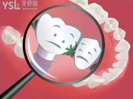 種植牙后可以吃東西嗎？來看種植牙后注意事項有哪些