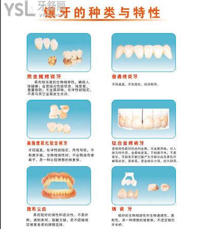 鑲牙疼嗎需要多長時(shí)間