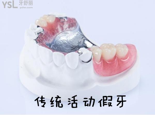 活動假牙
