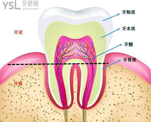 單顆牙齒敏感怎么辦？
