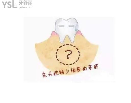 先天牙齒缺失沒有恒牙