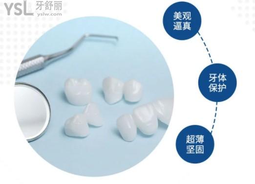 全瓷牙貼面優(yōu)點(diǎn)