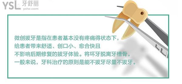 微創(chuàng)拔牙的優(yōu)勢(shì)