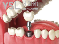 洛陽(yáng)九龍口腔門診部怎么樣