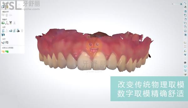 青島維樂口腔醫(yī)院3D技術(shù)