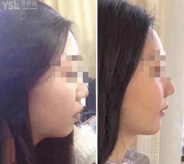 2021年格萊美口腔醫(yī)院價目表 網(wǎng)友反饋正畸技術(shù)較好 .jpg