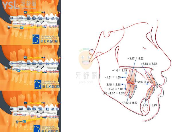 北京慶北米亞口腔矯正優(yōu)勢(shì)