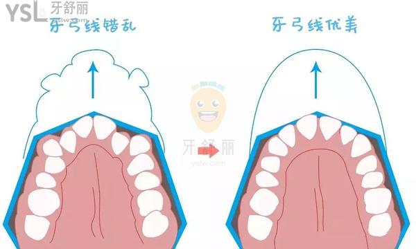 上海悅康齒科正規(guī)靠譜嗎_地址_視頻_口碑好不好_收費(fèi)標(biāo)準(zhǔn)_能用嗎