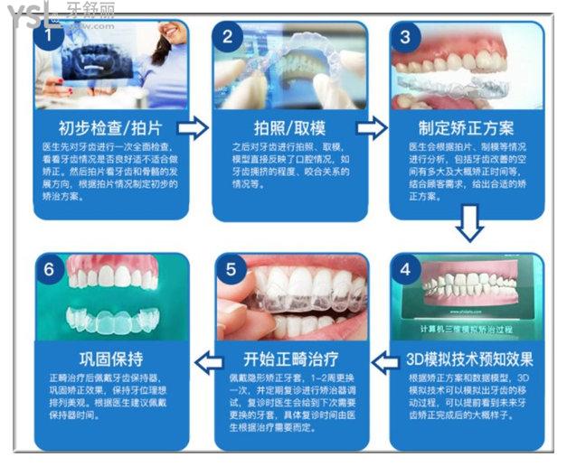 北京溪美康口腔矯正過程