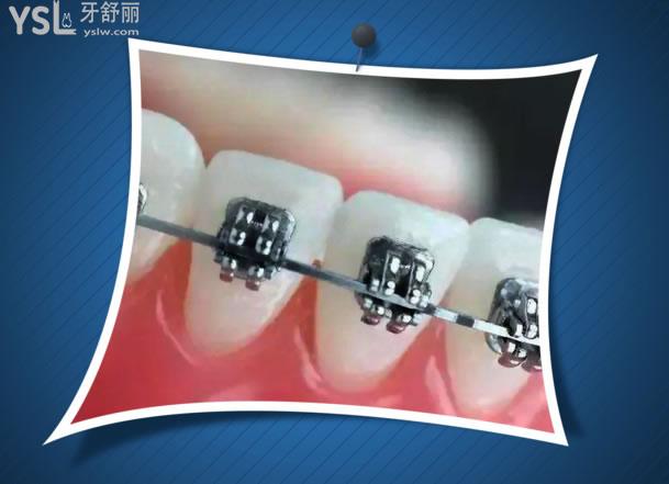 杭州齊爾口腔靠譜嗎，在這里看牙是怎樣的體驗(yàn).jpg