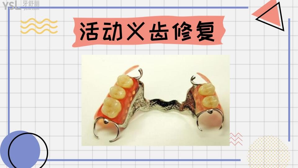 牙齒修復(fù)的幾種方法和價格如何呢 .jpg