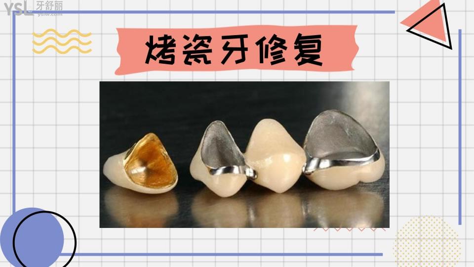 牙齒修復(fù)的幾種方法和價格如何呢 .jpg