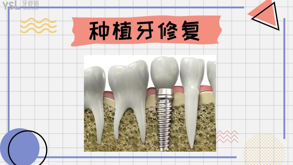 牙齒修復(fù)的幾種方法和價格如何呢 .jpg