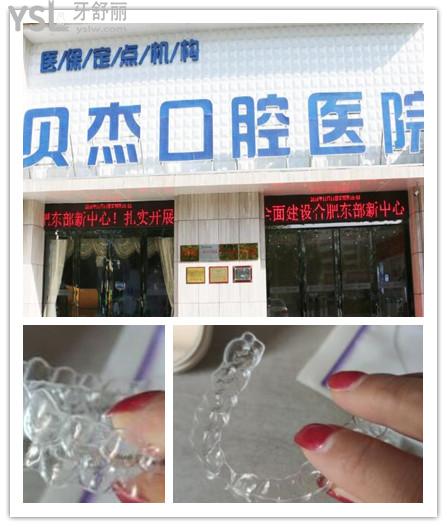 隱形矯正.jpg