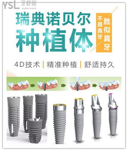 2021年瑞典諾貝爾種植牙全系列價格表 與瑞士ITI.jpg