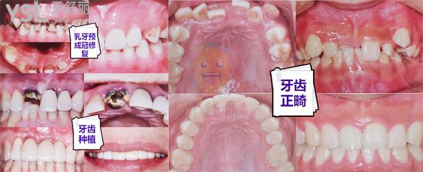 體驗(yàn)參考