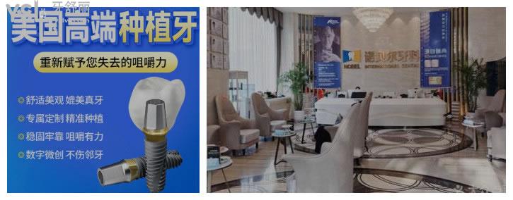 西安市全口種植牙價(jià)格表