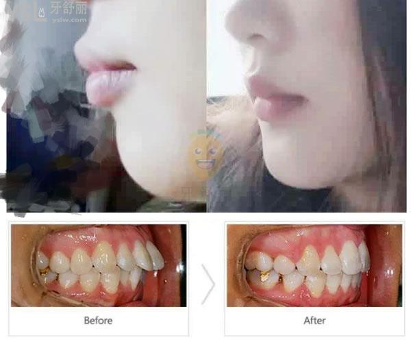 網(wǎng)友評價投稿-湛江華美口腔怎么樣