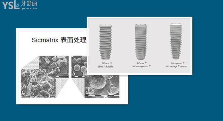 瑞士sic種植體和iti哪個好