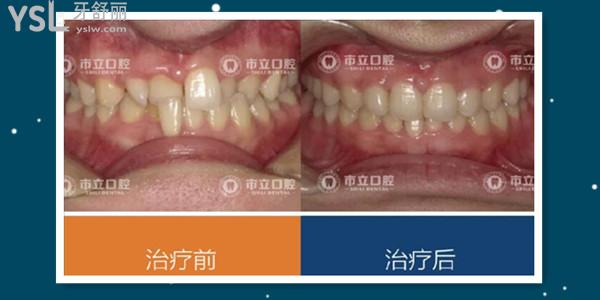 南寧市立口腔門診收費(fèi)標(biāo)準(zhǔn)更新 親診患者說(shuō) 醫(yī)生技術(shù)好價(jià)格便宜還能刷**.jpg