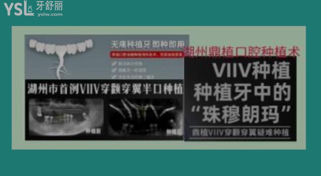 湖州看牙科哪個(gè)醫(yī)院好
