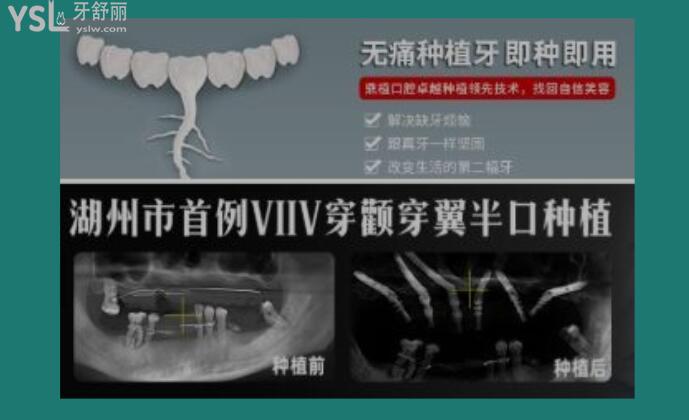 湖州看牙科哪個(gè)醫(yī)院好