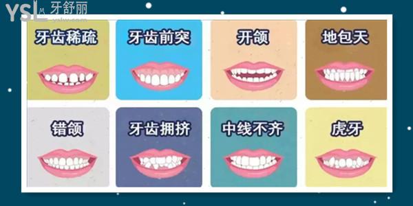 12歲兒童牙齒矯正費用是多少 牙齒矯正時應注意些什么呢.jpg